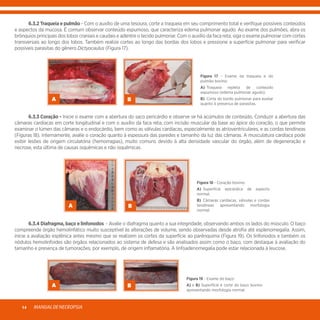 MANUALDENECROPSIA14
	 6.3.2 Traqueia e pulmão - Com o auxílio de uma tesoura, corte a traqueia em seu comprimento total e verifique possíveis conteúdos
e aspectos da mucosa. É comum observar conteúdo espumoso, que caracteriza edema pulmonar agudo. Ao exame dos pulmões, abra os
brônquios principais dos lobos craniais e caudais e adentre o tecido pulmonar. Com o auxílio da faca reta, siga o exame pulmonar com cortes
transversais ao longo dos lobos. Também realize cortes ao longo das bordas dos lobos e pressione a superfície pulmonar para verificar
possíveis parasitas do gênero Dictyocaulus (Figura 17).
A B
Figura 17 - Exame da traqueia e do
pulmão bovino:
A)	 Traqueia repleta de conteúdo
espumoso (edema pulmonar agudo).
B)	 Corte do bordo pulmonar para avaliar
quanto à presença de parasitas.
	 6.3.3 Coração - Inicie o exame com a abertura do saco pericárdio e observe se há acúmulos de conteúdo. Conduzir a abertura das
câmaras cardíacas em corte longitudinal e com o auxílio da faca reta, com incisão muscular da base ao ápice do coração, o que permite
examinar o lúmen das câmaras e o endocárdio, bem como as válvulas cardíacas, especialmente as atrioventriculares, e as cordas tendíneas
(Figuras 18). Internamente, avalie o coração quanto à espessura das paredes e tamanho da luz das câmaras. A musculatura cardíaca pode
exibir lesões de origem circulatória (hemorragias), muito comuns devido à alta densidade vascular do órgão, além de degeneração e
necrose, esta última de causas isquêmicas e não isquêmicas.
A B
Figura 18 - Coração bovino:
A)	 Superfície epicárdica de aspecto
normal.
B)	Câmaras cardíacas, válvulas e cordas
tendíneas apresentando morfologia
normal.
	 6.3.4 Diafragma, baço e linfonodos - Avalie o diafragma quanto a sua integridade, observando ambos os lados do músculo. O baço
compreende órgão hemolinfático muito susceptível às alterações de volume, sendo observadas desde atrofia até esplenomegalia. Assim,
inicie a avaliação esplênica antes mesmo que se realizem os cortes da superfície ao parênquima (Figura 19). Os linfonodos e também os
nódulos hemolinfoides são órgãos relacionados ao sistema de defesa e são analisados assim como o baço, com destaque à avaliação do
tamanho e presença de tumorações, por exemplo, de origem inflamatória. A linfoadenomegalia pode estar relacionada à leucose.
A B
Figura 19 - Exame do baço:
A) e B) Superfície e corte do baço bovino
apresentando morfologia normal.
 