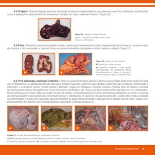 MANUALDENECROPSIA 15
	 6.3.5Fígado- Observe o fígado quanto às alterações de volume, irregularidades e opacidade na superfície, nodulações, modificações
na cor e parênquima, realizando cortes transversais seriados em toda a extensão hepática (Figura 20).
Figura 20 - Exame do fígado bovino:
avalie a superfície e realize cortes para
acessar o parênquima.
	 6.3.6 Rins - Examine os rins externamente e avalie o parênquima internamente (corte longitudinal único ao longo da curvatura maior
até alcançar o hilo, removendo a cápsula). Observe possíveis alterações nas regiões cortical, medular e pélvica (Figura 21).
A B
Figura 21 - Exame dos rins bovino:
A) Superfície e corte normais.
B) Superfície irregular e com pontos
esbranquiçados de distribuição difusa
(microabscessos e áreas de necrose -
nefrite embólica e áreas de infarto renal).
	 6.3.7 Pré-estômagos, estômago e intestino - Observe o posicionamento gástrico à abertura da cavidade abdominal, tendo em vista
que o timpanismo e os deslocamentos são alterações comuns. Siga com a abertura das câmaras a partir de suas curvaturas, examinando o
conteúdo e a mucosa do rúmen, retículo, omaso e abomaso (Figura 22). Manipule o mínimo possível a mucosa antes de realizar a colheita
de material para exames. Nos pilares do rúmen de bovinos confinados, são comuns as úlceras decorrentes da dieta rica em carboidratos.
Outras alterações no rúmen e retículo incluem cicatriz de úlceras ou de perfurações por corpos estranhos pontiagudos. A serosa e a mucosa
do abomaso podem exibir parasitoses como haemoncose e ostertagiose. O intestino é de grande extensão e pode exibir ampla variedade
de enfermidades e lesões. Por esta razão, procure distender as alças intestinais desde o duodeno até a porção final do cólon. Sugere-se o
posicionamento em desenho de onda para facilitar a abertura e avaliação (Figura 23).
A B C D
Figura 22 - Exame dos pré-estômagos, estômago e intestino:
A) e B) Superfície serosa e conteúdo luminal normais do rúmen, retículo, omaso e abomaso.
C) Superfície serosa do intestino e D) Conteúdo do intestino delgado de consistência pastosa e coloração clara.
 