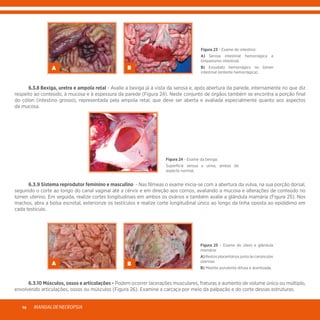 MANUALDENECROPSIA16
	 6.3.8 Bexiga, uretra e ampola retal - Avalie a bexiga já à vista da serosa e, após abertura da parede, internamente no que diz
respeito ao conteúdo, à mucosa e à espessura da parede (Figura 24). Neste conjunto de órgãos também se encontra a porção final
do cólon (intestino grosso), representada pela ampola retal, que deve ser aberta e avaliada especialmente quanto aos aspectos
da mucosa.
A B
Figura 23 - Exame do intestino:
A) Serosa intestinal hemorrágica e
timpanismo intestinal.
B) Exsudato hemorrágico no lúmen
intestinal (enterite hemorrágica).
Figura 24 - Exame da bexiga:
Superfície serosa e urina, ambas de
aspecto normal.
	 6.3.9 Sistema reprodutor feminino e masculino - Nas fêmeas o exame inicia-se com a abertura da vulva, na sua porção dorsal,
seguindo o corte ao longo do canal vaginal até a cérvix e em direção aos cornos, avaliando a mucosa e alterações de conteúdo no
lúmen uterino. Em seguida, realize cortes longitudinais em ambos os ovários e também avalie a glândula mamária (Figura 25). Nos
machos, abra a bolsa escrotal, exteriorize os testículos e realize corte longitudinal único ao longo da linha oposta ao epidídimo em
cada testículo.
A B
Figura 25 - Exame do útero e glândula
mamária:
A)Restos placentários junto às carúnculas
uterinas.
B) Mastite purulenta difusa e acentuada.
	 6.3.10 Músculos, ossos e articulações - Podem ocorrer lacerações musculares, fraturas e aumento de volume único ou múltiplo,
envolvendo articulações, ossos ou músculos (Figura 26). Examine a carcaça por meio da palpação e do corte dessas estruturas.
 