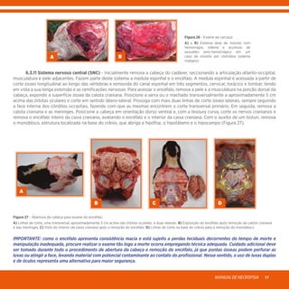 MANUALDENECROPSIA 17
A B
Figura 26 - Exame da carcaça:
A) e B) Extensa área de miosite com
hemorragia, edema e acúmulo de
exsudato sero-hemorrágico em um
caso de miosite por clotrídios (edema
maligno).
	 6.3.11 Sistema nervoso central (SNC) - Inicialmente remova a cabeça do cadáver, seccionando a articulação atlanto-occipital,
musculatura e pele adjacentes. Fazem parte deste sistema a medula espinhal e o encéfalo. A medula espinhal é acessada a partir de
corte ósseo longitudinal ao longo das vértebras e removida do canal espinhal em três segmentos, cervical, torácico e lombar, tendo
em vista a sua longa extensão e as ramificações nervosas. Para acessar o encéfalo, remova a pele e a musculatura na porção dorsal da
cabeça, expondo a superfície óssea da calota craniana. Posicione a serra ou o machado transversalmente a aproximadamente 5 cm
acima das órbitas oculares e corte em sentido látero-lateral. Prossiga com mais duas linhas de corte ósseo laterais, sempre seguindo
a face interna dos côndilos occipitais, fazendo com que as mesmas encontrem o corte transversal primário. Em seguida, remova a
calota craniana e as meninges. Posicione a cabeça em orientação dorso ventral e, com a tesoura curva, corte os nervos cranianos e
remova o encéfalo inteiro da caixa craniana, avaliando o encéfalo e o interior da caixa craniana. Com o auxílio de um bisturi, remova
o monobloco, estrutura localizada na base do crânio, que abriga a hipófise, o hipotálamo e o hipocampo (Figura 27).
A
B C D
Figura 27 - Abertura da cabeça para exame do encéfalo:
A) Linhas de corte, uma transversal, aproximadamente 5 cm acima das órbitas oculares, e duas laterais. B) Exposição do encéfalo após remoção da calota craniana
e das meninges. C) Vista do interior da caixa craniana após a remoção do encéfalo. D) Linhas de corte na base do crânio para a remoção do monobloco.
IMPORTANTE: como o encéfalo apresenta consistência macia e está sujeito a perdas teciduais decorrentes do tempo de morte e
manipulação inadequada, procure realizar o exame tão logo a morte ocorra empregando técnica adequada. Cuidado adicional deve
ser tomado durante todo o procedimento de abertura da cabeça e remoção do encéfalo, já que pontas ósseas podem perfurar as
luvas ou atingir a face, levando material com potencial contaminante ao contato do profissional. Nesse sentido, o uso de luvas duplas
e de óculos representa uma alternativa para maior segurança.
 