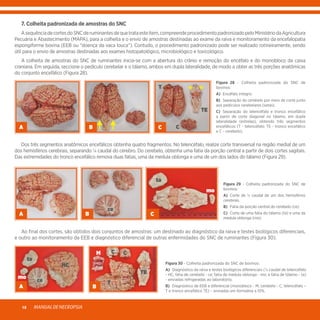 MANUALDENECROPSIA18
	 7. Colheita padronizada de amostras do SNC
	 AsequênciadecortesdoSNCderuminantesdequetrataesteitem,compreendeprocedimentopadronizadopeloMinistériodaAgricultura
Pecuária e Abastecimento (MAPA), para a colheita e o envio de amostras destinadas ao exame da raiva e monitoramento da encefalopatia
espongiforme bovina (EEB ou “doença da vaca louca”). Contudo, o procedimento padronizado pode ser realizado rotineiramente, sendo
útil para o envio de amostras destinadas aos exames histopatológico, microbiológico e toxicológico.
	 A colheita de amostras do SNC de ruminantes inicia-se com a abertura do crânio e remoção do encéfalo e do monobloco da caixa
craniana. Em seguida, seccione o pedículo cerebelar e o tálamo, ambos em dupla lateralidade, de modo a obter as três porções anatômicas
do conjunto encefálico (Figura 28).
A
Figura 28 - Colheita padronizada do SNC de
bovinos:
A)	 Encéfalo íntegro.
B)	 Separação do cerebelo por meio de corte junto
aos pedículos cerebelares (setas).
C)	 Separação do telencéfalo e tronco encefálico
a partir de corte diagonal no tálamo, em dupla
lateralidade (estrelas), obtendo três segmentos
encefálicos (T - telencéfalo; TE - tronco encefálico
e C - cerebelo).
	 Dos três segmentos anatômicos encefálicos obtenha quatro fragmentos. No telencéfalo, realize corte transversal na região medial de um
dos hemisférios cerebrais, separando ¼ caudal do cérebro. Do cerebelo, obtenha uma fatia da porção central a partir de dois cortes sagitais.
Das extremidades do tronco encefálico remova duas fatias, uma da medula oblonga e uma de um dos lados do tálamo (Figura 29).
A
Figura 29 - Colheita padronizada do SNC de
bovinos:
A)	 Corte de ¼ caudal de um dos hemisférios
cerebrais.
B)	 Fatia da porção central do cerebelo (ce).
C)	 Corte de uma fatia do tálamo (ta) e uma da
medula oblonga (mo).
	 Ao final dos cortes, são obtidos dois conjuntos de amostras: um destinado ao diagnóstico da raiva e testes biológicos diferenciais,
e outro ao monitoramento da EEB e diagnóstico diferencial de outras enfermidades do SNC de ruminantes (Figura 30).
Figura 30 - Colheita padronizada do SNC de bovinos:
A)	 Diagnóstico da raiva e testes biológicos diferenciais (¼ caudal de telencéfalo
- HC; fatia de cerebelo - ce; fatia de medula oblonga - mo; e fatia de tálamo - ta)
- enviadas refrigeradas ao laboratório.
B)	 Diagnóstico de EEB e diferencial (monobloco - M, cerebelo - C, telencéfalo –
T e tronco encefálico TE) – enviadas em formalina a 10%.
B C
T
TE
C
B
ce
C
ta
mo
A
ta
mo
ce
HC
B
C C
T
TE
M
 