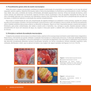 MANUALDENECROPSIA8
	 4. Procedimentos gerais antes do exame necroscópico
	 Antes de iniciar o exame necroscópico certifique-se quanto à autorização do proprietário ou responsável, ou no caso de animal
segurado, solicite a apólice. Obtenha informações sobre a rotina da propriedade e os fenômenos que antecederam a morte. Verifique
raça, idade, sexo, peso, condições de manejo, alimentação, densidade populacional, sintomas, tempo de duração da doença, sobre
outros animais que adoeceram ou morreram, aspectos de flora e fauna, localização e tipo de aguadas, topografia da área, tipo de
solo e atividades agrícolas e/ou industriais nas redondezas. Quanto mais informações, mais fácil será a compreensão dos achados de
necropsia, a colheita de material e a solicitação dos exames complementares.
	 Para evitar a contaminação do solo e/ou disseminação de agentes biológicos ao ambiente e outros animais, quando em campo,
escolha um local isolado, à sombra, com boa iluminação, e procure forrar o solo com plástico, lona ou similar. Ao final do procedimento,
utilize medidas sanitárias básicas para enterrar ou descartar os despojos. Água é um item importante durante o exame necroscópico.
Entretanto, para evitar contaminação, não realize o exame junto a nascentes, rios, córregos e açudes. Quando possível, realize o
procedimento em local com estrutura de água, luz, esgoto e mesa para apoiar o cadáver, bem como janelas e portas para evitar
as moscas.
	 5. Princípios e variáveis da avaliação macroscópica
	 O objetivo da avaliação necroscópica é reconhecer lesões, explicar como e porque essas ocorreram e assim determinar o diagnóstico.
Desta forma, a ferramenta de grande utilidade à avaliação macroscópica é a observação minuciosa. A descrição detalhada favorece
a interpretação correta, facilitando o raciocínio patológico e a conclusão do diagnóstico. De modo geral, as alterações macroscópicas
são descritas considerando diferentes variáveis (localização, tamanho, cor, forma, consistência, número, extensão, superfície, corte,
conteúdo, distribuição e odor), que se aplicam às lesões e aos órgãos (ver alguns exemplos nas figuras 3, 4, 5, 6, 7, 8 e 9).
Figura 3 - Pulmão lateral esquerdo bovino:
A)	Aspecto macroscópico normal.
B)	Opacidade de pleura visceral e
hemorragia multifocal no lobo pulmonar
diafragmático esquerdo (linha tracejada).
Figura 4 - Linfonodo bovino:
A)	Aspecto macroscópico normal à
superfície de corte.
B)	Linfadenomegalia devido a acúmulo
de exsudato purulento.
A B
A B
 
