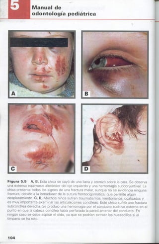 manual de odontopediatria