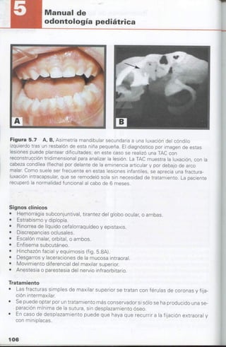 manual de odontopediatria