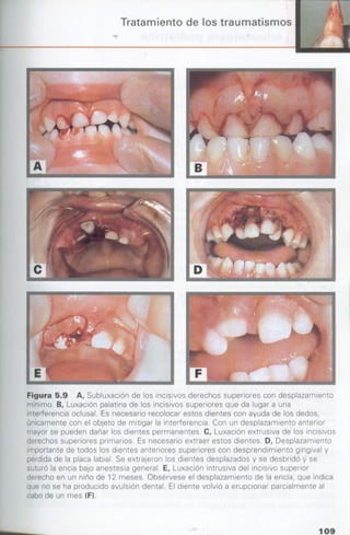 manual de odontopediatria