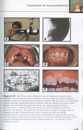 manual de odontopediatria