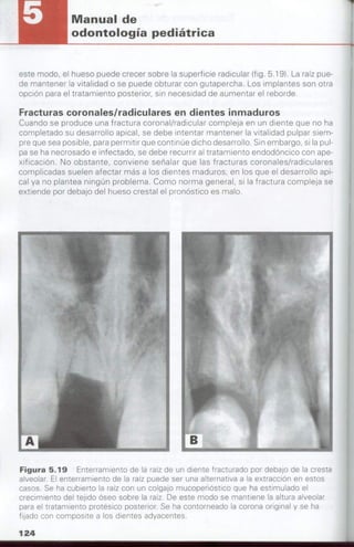 manual de odontopediatria
