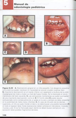 manual de odontopediatria