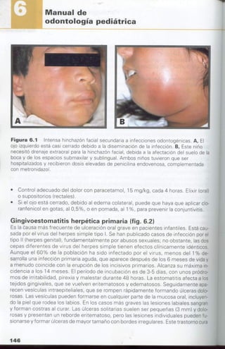 manual de odontopediatria