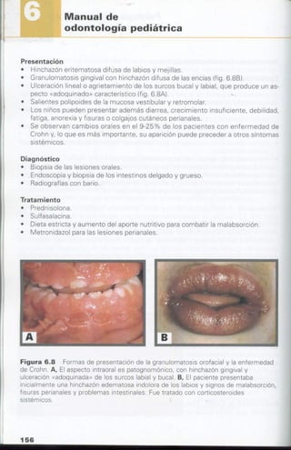 manual de odontopediatria