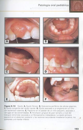 manual de odontopediatria
