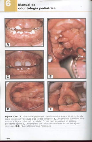 manual de odontopediatria