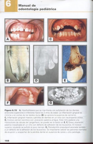 manual de odontopediatria