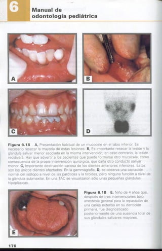 manual de odontopediatria