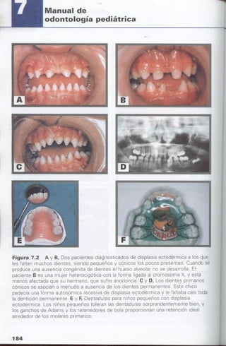 manual de odontopediatria