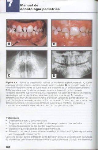 manual de odontopediatria
