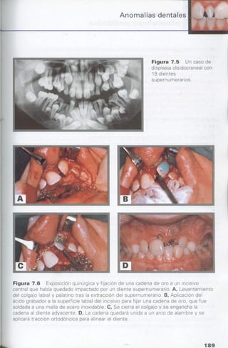 manual de odontopediatria