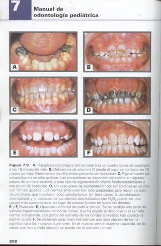 manual de odontopediatria