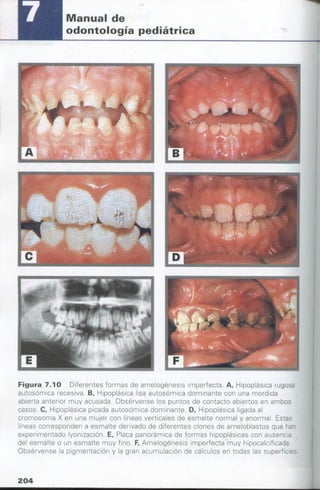 manual de odontopediatria