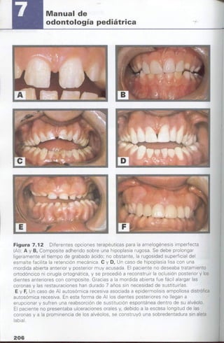 manual de odontopediatria