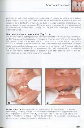 manual de odontopediatria