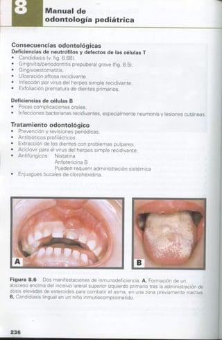 manual de odontopediatria