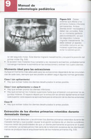 manual de odontopediatria
