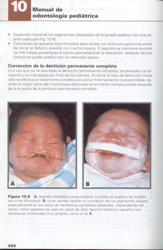 manual de odontopediatria