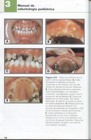 manual de odontopediatria