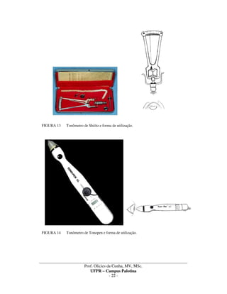 _____________________________________________________________________________________
Prof. Olicies da Cunha, MV, MSc.
UFPR – Campus Palotina
- 22 -
FIGURA 13 Tonômetro de Shiötz e forma de utilização.
FIGURA 14 Tonômetro de Tonopen e forma de utilização.
 