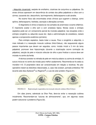 _____________________________________________________________________________________
Prof. Olicies da Cunha, MV, MSc.
UFPR – Campus Palotina
- 31 -
- Adquirido (cicatricial): seqüela de enoftalmo, cicatrizes de conjuntiva ou pálpebras. Os
sinais clínicos aparecem em decorrência do contato dos pêlos palpebrais e cílios com a
córnea, causando dor, desconforto, lacrimejamento, blefarospasmo e até ceratite.
No exame físico são encontrados sinais clínicos que sugerem a doença, como
epífora, blefarospasmo, fotofobia, secreção e alterações corneais.
O diagnóstico é clínico e baseia-se nos achados da anamnese e exame oftálmico.
É importante avaliar o olho sem e com anestesia tópica. Muitas vezes o entrópio
espástico pode ser um componente parcial da inversão palpebral, nas situações onde o
entrópio congênito ou adquirido cause dor. Após a administração do anestésico, restará
apenas o componente anatômico (primário).
Para entrópio espástico, basta tratar a causa. Para o congênito e adquirido, o
mais indicado é a ressecção músculo cutânea (Hotz-Celsus), não esquecendo alguns
passos importantes que devem ser seguidos, como: incisão inicial a 3 mm do tarso
palpebral, promover leve hipocorreção (durante a cicatrização ocorre contração da
pálpebra), secção da pele e músculo orbicular do olho e para finalizar a sutura deve ser
iniciada no centro da ferida.
A técnica consiste na retirada de pele em meia-lua abaixo ou acima do entrópio. A
sutura inicia-se no centro da incisão para melhor acabamento. Recomenda-se fio seda ou
monáilon 4-0. O proprietário deve ser conscientizado em relação a recidivas. No pós-
operatório tratam-se distúrbios relacionados, e, caso não existam, pomada antibiótica TID
durante sete dias (Epitezan®
ou Regenon®
), e uso de colar protetor (Figura 21).
FIGURA 21 Representação esquemática da ressecção músculo cutânea (Hotz-Celsus).
Em cães jovens, sobretudo os Shar Peis, deve-se evitar a ressecção cutânea
inicialmente. Recomendam-se “suturas de alinhavamento”, que, em algumas vezes
podem solucionar o problema (Figura 22).
 