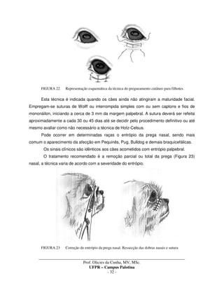 _____________________________________________________________________________________
Prof. Olicies da Cunha, MV, MSc.
UFPR – Campus Palotina
- 32 -
FIGURA 22 Representação esquemática da técnica do pregueamento cutâneo para filhotes.
Esta técnica é indicada quando os cães ainda não atingiram a maturidade facial.
Empregam-se suturas de Wolff ou interrompida simples com ou sem captons e fios de
mononáilon, iniciando a cerca de 3 mm da margem palpebral. A sutura deverá ser refeita
aproximadamente a cada 30 ou 45 dias até se decidir pelo procedimento definitivo ou até
mesmo avaliar como não necessário a técnica de Hotz-Celsus.
Pode ocorrer em determinadas raças o entrópio da prega nasal, sendo mais
comum o aparecimento da afecção em Pequinês, Pug, Bulldog e demais braquicefálicas.
Os sinais clínicos são idênticos aos cães acometidos com entrópio palpebral.
O tratamento recomendado é a remoção parcial ou total da prega (Figura 23)
nasal, a técnica varia de acordo com a severidade do entrópio.
FIGURA 23 Correção do entrópio da prega nasal. Ressecção das dobras nasais e sutura
 