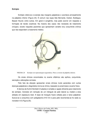 _____________________________________________________________________________________
Prof. Olicies da Cunha, MV, MSc.
UFPR – Campus Palotina
- 33 -
Ectrópio
Ectrópio refere-se à eversão das margens palpebrais e acontece principalmente
na pálpebra inferior (Figura 24). É comum nas raças São Bernardo, Cocker, Buldogue,
Basset Hound, entre outras. Em geral é congênito, mas pode ocorrer em resposta a
formação de tecido cicatricial. Na maioria dos casos não necessita de tratamento
cirúrgico, exceto naqueles pacientes que apresentam ceratite e/ou conjuntivite crônica
que não respondem a tratamento médico.
FIGURA 24 Ectrópio em representação esquemática. Note a eversão da pálpebra inferior.
Os sinais clínicos encontrados no exame oftálmico são epífora, conjuntivite,
secreção e alterações corneais.
Pelo fato da afecção apresentar sinais clínicos muito parecidos com outras
doenças palpebrais o diagnóstico torna-se clínico, baseado na anamnese e exame físico.
A técnica de Kuhnt-Hembolt (V-plastia) é simples e opção eficiente para tratamento
de ectrópio. Consiste em remoção de um triângulo de pele lateral ou medial a área
afetada em espessura total. A base do triangulo ficará voltada para o tarso palpebral.
Sutura-se a conjuntiva com poligalactina 910 5-0 e para pele recomenda-se fio seda ou
monáilon 4-0 (Figura 25).
 