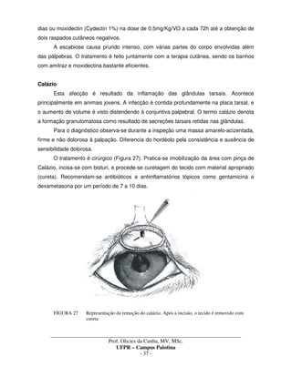 _____________________________________________________________________________________
Prof. Olicies da Cunha, MV, MSc.
UFPR – Campus Palotina
- 37 -
dias ou moxidectin (Cydectin 1%) na dose de 0,5mg/Kg/VO a cada 72h até a obtenção de
dois raspados cutâneos negativos.
A escabiose causa prurido intenso, com várias partes do corpo envolvidas além
das pálpebras. O tratamento é feito juntamente com a terapia cutânea, sendo os banhos
com amitraz e moxidectina bastante eficientes.
Calázio
Esta afecção é resultado da inflamação das glândulas tarsais. Acontece
principalmente em animais jovens. A infecção é contida profundamente na placa tarsal, e
o aumento de volume é visto distendendo à conjuntiva palpebral. O termo calázio denota
a formação granulomatosa como resultado de secreções tarsais retidas nas glândulas.
Para o diagnóstico observa-se durante a inspeção uma massa amarelo-acizentada,
firme e não dolorosa à palpação. Diferencia do hordéolo pela consistência e ausência de
sensibilidade dolorosa.
O tratamento é cirúrgico (Figura 27). Pratica-se imobilização da área com pinça de
Calázio, incisa-se com bisturi, e procede-se curetagem do tecido com material apropriado
(cureta). Recomendam-se antibióticos e antiinflamatórios tópicos como gentamicina e
dexametasona por um período de 7 a 10 dias.
FIGURA 27 Representação da remoção do calázio. Após a incisão, o tecido é removido com
cureta
 