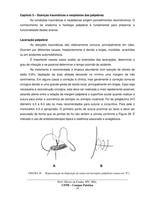 _____________________________________________________________________________________
Prof. Olicies da Cunha, MV, MSc.
UFPR – Campus Palotina
- 39 -
Capítulo 5 – Doenças traumáticas e neoplasias das pálpebras
As condições traumáticas e neoplásicas exigem porcedimentos reconstrutivos. O
conhecimento da anatomia e fisiologia palpebral é fundamental para preservar a
funcionalidade destes anexos.
Laceração palpebral
As afecções traumáticas são relativamente comuns, principalmente em cães.
Ocorrem por diferentes causas, freqüentemente é devido a brigas, mordidas, arranhões
ou em acidentes automobilísticos.
É importante nesses casos avaliar as extensões das lacerações, determinar o
grau de infecção e se possível determinar o tempo ocorrido do acidente.
No tratamento é recomendada a limpeza abundante com solução de cloreto de
sódio 0,9%, depilação da área afetada deixando no mínimo uma margem de três
centímetros. Em alguns casos a correção é clínica, mas geralmente a correção torna-se
cirúrgica devido a uma grande perda de tecido local, principalmente em brigas. Caso seja
necessária a reconstrução cirúrgica, esta deve ser realizada o mais rapidamente possível,
estando atento entre a relação da margem palpebral e superfície ocular quando realizar a
sutura para evitar a ocorrência de ectrópio ou entrópio cicatricial. Fio de poliglactina 910
diâmetro 4.0 a 6.0 são os mais recomendados para suturar a conjuntiva. Para pele o
mononáilon 4.0 é apropriado. O primeiro ponto de sutura proximal ao tarso e deve ser
executado de forma que as pontas do fio não atritem a córnea conforme a Figura 28. É
indicado o uso de antibioticoterapia tópica e sistêmica associado a analgésicos.
FIGURA 28 Representação da disposição da sutura em lacerações palpebrais (sutura em “8”).
 