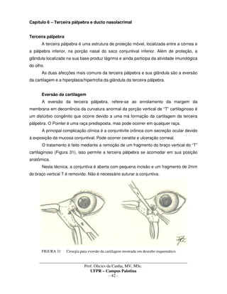 _____________________________________________________________________________________
Prof. Olicies da Cunha, MV, MSc.
UFPR – Campus Palotina
- 42 -
Capítulo 6 – Terceira pálpebra e ducto nasolacrimal
Terceira pálpebra
A terceira pálpebra é uma estrutura de proteção móvel, localizada entre a córnea e
a pálpebra inferior, na porção nasal do saco conjuntival inferior. Além de proteção, a
glândula localizada na sua base produz lágrima e ainda participa da atividade imunológica
do olho.
As duas afecções mais comuns da terceira pálpebra e sua glândula são a eversão
da cartilagem e a hiperplasia/hipertrofia da glândula da terceira pálpebra.
Eversão da cartilagem
A eversão da terceira pálpebra, refere-se ao enrolamento da margem da
membrana em decorrência da curvatura anormal da porção vertical de “T” cartilaginoso é
um distúrbio congênito que ocorre devido a uma má formação da cartilagem da terceira
pálpebra. O Pointer é uma raça predisposta, mas pode ocorrer em qualquer raça.
A principal complicação clínica é a conjuntivite crônica com secreção ocular devido
à exposição da mucosa conjuntival. Pode ocorrer ceratite e ulceração corneal.
O tratamento é feito mediante a remoção de um fragmento do braço vertical do “T”
cartilaginoso (Figura 31), isso permite a terceira pálpebra se acomodar em sua posição
anatômica.
Nesta técnica, a conjuntiva é aberta com pequena incisão e um fragmento de 2mm
do braço vertical T é removido. Não é necessário suturar a conjuntiva.
FIGURA 31 Cirurgia para eversão da cartilagem mostrada em desenho esquemático.
 