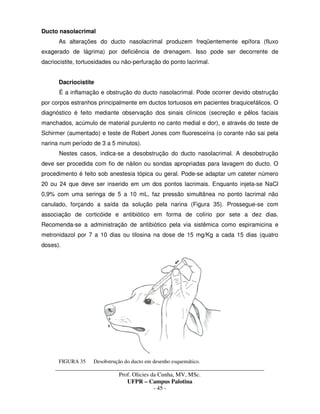 _____________________________________________________________________________________
Prof. Olicies da Cunha, MV, MSc.
UFPR – Campus Palotina
- 45 -
Ducto nasolacrimal
As alterações do ducto nasolacrimal produzem freqüentemente epífora (fluxo
exagerado de lágrima) por deficiência de drenagem. Isso pode ser decorrente de
dacriocistite, tortuosidades ou não-perfuração do ponto lacrimal.
Dacriocistite
É a inflamação e obstrução do ducto nasolacrimal. Pode ocorrer devido obstrução
por corpos estranhos principalmente em ductos tortuosos em pacientes braquicefálicos. O
diagnóstico é feito mediante observação dos sinais clínicos (secreção e pêlos faciais
manchados, acúmulo de material purulento no canto medial e dor), e através do teste de
Schirmer (aumentado) e teste de Robert Jones com fluoresceína (o corante não sai pela
narina num período de 3 a 5 minutos).
Nestes casos, indica-se a desobstrução do ducto nasolacrimal. A desobstrução
deve ser procedida com fio de náilon ou sondas apropriadas para lavagem do ducto. O
procedimento é feito sob anestesia tópica ou geral. Pode-se adaptar um cateter número
20 ou 24 que deve ser inserido em um dos pontos lacrimais. Enquanto injeta-se NaCl
0,9% com uma seringa de 5 a 10 mL, faz pressão simultânea no ponto lacrimal não
canulado, forçando a saída da solução pela narina (Figura 35). Prossegue-se com
associação de corticóide e antibiótico em forma de colírio por sete a dez dias.
Recomenda-se a administração de antibiótico pela via sistêmica como espiramicina e
metronidazol por 7 a 10 dias ou tilosina na dose de 15 mg/Kg a cada 15 dias (quatro
doses).
FIGURA 35 Desobstrução do ducto em desenho esquemático.
 
