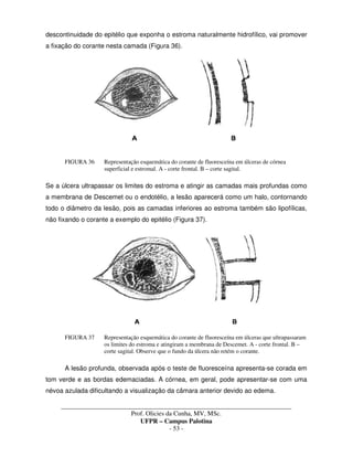 _____________________________________________________________________________________
Prof. Olicies da Cunha, MV, MSc.
UFPR – Campus Palotina
- 53 -
descontinuidade do epitélio que exponha o estroma naturalmente hidrofílico, vai promover
a fixação do corante nesta camada (Figura 36).
FIGURA 36 Representação esquemática do corante de fluoresceína em úlceras de córnea
superficial e estromal. A - corte frontal. B – corte sagital.
Se a úlcera ultrapassar os limites do estroma e atingir as camadas mais profundas como
a membrana de Descemet ou o endotélio, a lesão aparecerá como um halo, contornando
todo o diâmetro da lesão, pois as camadas inferiores ao estroma também são lipofílicas,
não fixando o corante a exemplo do epitélio (Figura 37).
FIGURA 37 Representação esquemática do corante de fluoresceína em úlceras que ultrapassaram
os limites do estroma e atingiram a membrana de Descemet. A - corte frontal. B –
corte sagital. Observe que o fundo da úlcera não retém o corante.
A lesão profunda, observada após o teste de fluoresceína apresenta-se corada em
tom verde e as bordas edemaciadas. A córnea, em geral, pode apresentar-se com uma
névoa azulada dificultando a visualização da câmara anterior devido ao edema.
 