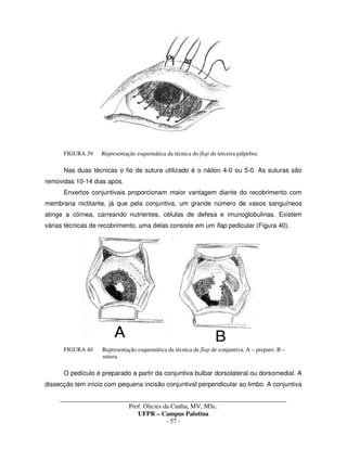 _____________________________________________________________________________________
Prof. Olicies da Cunha, MV, MSc.
UFPR – Campus Palotina
- 57 -
FIGURA 39 Representação esquemática da técnica do flap de terceira pálpebra.
Nas duas técnicas o fio de sutura utilizado é o náilon 4-0 ou 5-0. As suturas são
removidas 10-14 dias após.
Enxertos conjuntivais proporcionam maior vantagem diante do recobrimento com
membrana nictitante, já que pela conjuntiva, um grande número de vasos sanguíneos
atinge a córnea, carreando nutrientes, células de defesa e imunoglobulinas. Existem
várias técnicas de recobrimento, uma delas consiste em um flap pedicular (Figura 40).
FIGURA 40 Representação esquemática da técnica de flap de conjuntiva. A – preparo. B –
sutura.
O pedículo é preparado a partir da conjuntiva bulbar dorsolateral ou dorsomedial. A
dissecção tem início com pequena incisão conjuntival perpendicular ao limbo. A conjuntiva
 