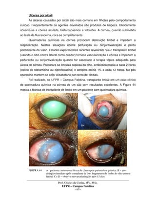 _____________________________________________________________________________________
Prof. Olicies da Cunha, MV, MSc.
UFPR – Campus Palotina
- 60 -
Ulceras por álcali
As úlceras causadas por álcali são mais comuns em filhotes pelo comportamento
curioso. Freqüentemente os agentes envolvidos são produtos de limpeza. Clinicamente
observa-se a córnea azulada, blefarospasmos e fotofobia. A córnea, quando submetida
ao teste da fluoresceína, cora-se completamente
Queimaduras químicas na córnea provocam destruição limbal e impedem a
reepitelização. Nestas situações ocorre perfuração ou conjuntivalização e perda
permanente da visão. Estudos experimentais recentes revelaram que o transplante limbal
(usando o olho contra lateral como doador) fornece vascularização a córnea e impedem a
perfuração ou conjuntivalização quando for associado à terapia tópica adequada para
úlcera de córnea. Preconiza-se limpeza copiosa do olho, antibioticoterapia a cada 2 horas
(colírio de tobramicina ou ciprofloxacina) e atropina colírio 1% a cada 12 horas. No pós
operatório mantem-se colar elisabetano por cerca de 10 dias.
Foi realizado, na UFPR – Campus Palotina, transplante limbal em um caso clínico
de queimadura química na córnea de um cão com resultados excelentes. A Figura 44
mostra a técnica de transplante de limbo em um paciente com queimadura química.
FIGURA 44 A - paciente canino com úlcera de córnea por queimadura química. B – pós-
cirúrgico imediato após transplante de dois fragmentos de limbo do olho contra-
lateral. C e D – observe neovascularização após 15 dias.
 
