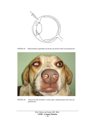 _____________________________________________________________________________________
Prof. Olicies da Cunha, MV, MSc.
UFPR – Campus Palotina
- 70 -
FIGURA 45 Representação esquemática da técnica de atrofia ocular com gentamicina.
FIGURA 46 Aspecto do olho atrofiado 11 meses após a administração intra-vítrea de
gentamicina.
 