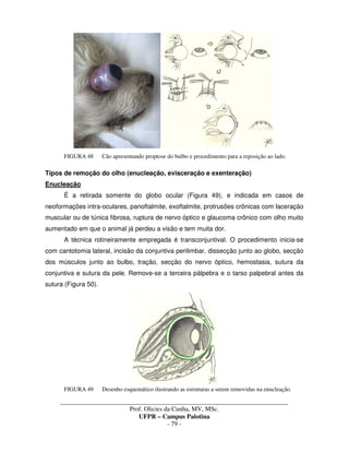 _____________________________________________________________________________________
Prof. Olicies da Cunha, MV, MSc.
UFPR – Campus Palotina
- 79 -
FIGURA 48 Cão apresentando proptose do bulbo e procedimento para a reposição ao lado.
Tipos de remoção do olho (enucleação, evisceração e exenteração)
Enucleação
É a retirada somente do globo ocular (Figura 49), e indicada em casos de
neoformações intra-oculares, panoftalmite, exoftalmite, protrusões crônicas com laceração
muscular ou de túnica fibrosa, ruptura de nervo óptico e glaucoma crônico com olho muito
aumentado em que o animal já perdeu a visão e tem muita dor.
A técnica rotineiramente empregada é transconjuntival. O procedimento inicia-se
com cantotomia lateral, incisão da conjuntiva perilimbar, dissecção junto ao globo, secção
dos músculos junto ao bulbo, tração, secção do nervo óptico, hemostasia, sutura da
conjuntiva e sutura da pele. Remove-se a terceira pálpebra e o tarso palpebral antes da
sutura (Figura 50).
FIGURA 49 Desenho esquemático ilustrando as estruturas a serem removidas na enucleação.
 