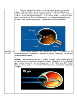 Para uma visão perfeita, a luz entra no olho atravessando a córnea (frente do
olho), o critalino, o vitreo e é focada num ponto único na retina (parte de trás do olho)
onde ira estimular as células da retina. (fotorreceptores). A partir desse ponto, um impulso
eletrico, sera transmitido pelo nervo optivo e via visual ate o cérebro e ser interpretada na
região responsável pela visão (cortex occiptal). Se houver alterações na córnea, pupila,
cristalino, vitreo, retina ou nervo óptico, a imagem não se formar corretamente.

Distúrbios
Refração

de

Quando existem problemas na curvatura da córnea, do cristalino ou no
comprimento do olho, acontecem os distúrbios de refração (ametropias). Os principais
problemas de refração são:
Miopia - É como se denomina o erro de refração em que a imagem focaliza antes de
chegar à retina. As pessoas com miopia preferem usar a visão para perto. Têm dificuldade
para enxergar à distância e comumente aproximam-se dos objetos para vê-los melhor.
Franzir a testa e apertar os olhos também são sinais comuns em pacientes míopes não
corrigidos.

 