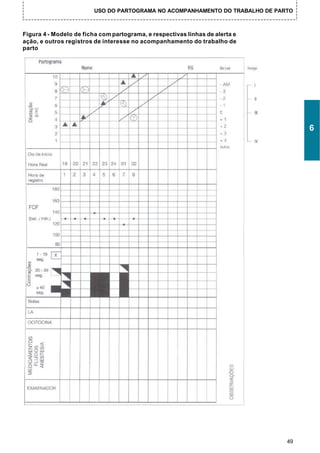 USO DO PARTOGRAMA NO ACOMPANHAMENTO DO TRABALHO DE PARTO



Figura 4 - Modelo de ficha com partograma, e respectivas linhas de alerta e
ação, e outros registros de interesse no acompanhamento do trabalho de
parto




                                                                                    6




                                                                               49
 