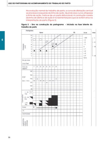 USO DO PARTOGRAMA NO ACOMPANHAMENTO DO TRABALHO DE PARTO



                    Na evolução normal do trabalho de parto, a curva de dilatação cervical
                    se processa à esquerda da linha de ação. Quando essa curva ultrapassa
                    a linha de ação, trata-se de um parto disfuncional. A construção correta
                    da linha de alerta e de ação é fundamental para que se evitem erros na
                    interpretação do parto (Figura 5).

               Figura 5 - Erro na construção do partograma - iniciado na fase latente do
               trabalho de parto




6




    50
 
