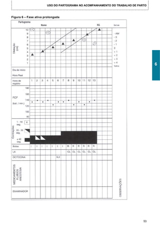 USO DO PARTOGRAMA NO ACOMPANHAMENTO DO TRABALHO DE PARTO



Figura 6 – Fase ativa prolongada




                                                                                  6




                                                                             53
 