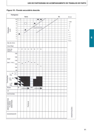 USO DO PARTOGRAMA NO ACOMPANHAMENTO DO TRABALHO DE PARTO



Figura 10 - Parada secundária descida




                                                                                  6




                                                                             61
 