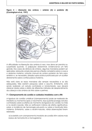 ASSISTÊNCIA À MULHER NO PARTO NORMAL



Figura 3 – Liberação dos ombros – anterior (A) e posterior (B)
(Cunningham et al., 1997)




                                                                                         9




A dificuldade na liberação dos ombros é rara, mas deve ser prevista ou
suspeitada quando, à palpação abdominal, evidenciar-se um feto
grande. Nos casos de distócia de ombros, algumas manobras podem ser
aplicadas: abdução ampla das pernas e flexão completa sobre a coxa e
o abdome materno; rotação manual do ombro posterior do feto para
anterior e, se necessário, pressão supra-púbica praticada por um auxiliar
diretamente sobre a sínfise púbica materna.

Não está claro se essas manobras são sempre necessárias e se são
adequadas. Não existem pesquisas sobre o assunto. Entretanto, está
sendo realizado um estudo controlado e randomizado, que deverá
oferecer dados sobre o efeito de diferentes métodos de desprendimento
da cabeça e dos ombros do feto sobre o períneo.

7 – Clampeamento do cordão e cuidados imediatos com o RN

A ligadura do cordão umbilical (clampeamento) pode ser realizada de
imediato ou momentos após o nascimento. Essa questão já exigiu estudos
controlados sobre os efeitos do momento da ligadura do cordão na mãe
e no recém-nascido. Não se verificaram indícios de efeitos significativos
sobre a incidência de hemorragia pós-parto ou sobre a transfusão feto-
materna. Entretanto, sobre o recém-nascido, várias observações foram
relatadas:

  a) os bebês com clampeamento imediato de cordão têm valores mais
  baixos de hematócrito e hemoglobina;




                                                                                    83
 