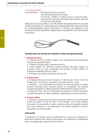 ASSISTÊNCIA À MULHER NO PARTO FÓRCIPE



                      3. Fórcipe de Piper
                      Características:   Articulação fixa por encaixe
                                         Curvatura perineal acentuada
                                         Curvaturas cefálica e pélvica pouco pronunciadas,
                                         promovendo discreta solicitação do assoalho perineal
                                         no momento da tração
                      Utilização: No parto pélvico com dificuldade de desprendimento do pólo
                      cefálico derradeiro. A cabeça precisa, obrigatoriamente, estar insinuada.
                      Na indisponibilidade deste instrumento, o fórcipe de Kielland ou de
                      Simpsom poderão substituí-lo, dependendo da preferência e treinamento
                      do parteiro.


11




                      Classificação do fórcipe em relação à altura da apresentação

                      1. Fórcipe de alívio
                         • Cabeça visível no intróito vaginal, sem necessidade de separação
                         manual dos grandes lábios,
                         • Cabeça rechaçando o assoalho pélvico,
                         • Sutura sagital no diâmetro antero-posterior (occipito púbico ou
                         occipito sacro) ou nas variedades de posição occipito direita ou
                         esquerda anteriores (ODA ou OEA),
                         • Rotação da cabeça fetal não excede 45°.

                      2. Fórcipe baixo
                         • Cabeça fetal pelo menos no plano +2 de De Lee / entre III e IV de
                         Hodge sem, no entanto, alcançar o assoalho pélvico, com:
                         • Rotação <_ 45° (variedade de posição occipito esquerda ou direita
                         anterior rodando para occipito púbico ou variedade de posição
                         occipito esquerda ou direita posterior rodando para occipito sacro),
                         • Rotação maior que 45º (variedade de posição occipito transversa,
                         occipito esquerda ou direita posterior rodando para occipito púbico).

                      3. Fórcipe médio
                         • Quando a aplicação do fórcipe faz-se em cabeca cujo vértice está
                         acima do plano +2 de De Lee / III de Hodge, com pólo cefálico
                         insinuado. É conveniente e ideal o parecer de outro obstetra devido
                         aos riscos inerentes à sua aplicação. Na prática obstétrica atual é
                         procedimento de exceção.

                      Indicações

                      A utilização do fórcipe torna-se justificável em casos que ameacem o
                      bem-estar materno e/ou fetal e que possam ser revertidos ou melhorados
                      pelo uso adequado e seguro do instrumento.




     98
 