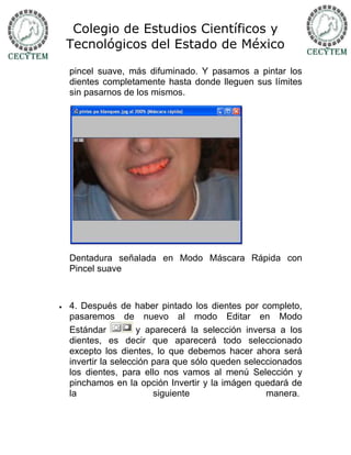 Colegio de Estudios Científicos y
    Tecnológicos del Estado de México

    pincel suave, más difuminado. Y pasamos a pintar los
    dientes completamente hasta donde lleguen sus límites
    sin pasarnos de los mismos.




    Dentadura señalada en Modo Máscara Rápida con
    Pincel suave



   4. Después de haber pintado los dientes por completo,
    pasaremos de nuevo al modo Editar en Modo
    Estándar          y aparecerá la selección inversa a los
    dientes, es decir que aparecerá todo seleccionado
    excepto los dientes, lo que debemos hacer ahora será
    invertir la selección para que sólo queden seleccionados
    los dientes, para ello nos vamos al menú Selección y
    pinchamos en la opción Invertir y la imágen quedará de
    la                    siguiente                 manera.
 